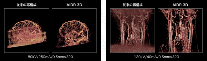 CT解析イメージ写真