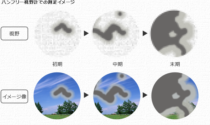 ハンフリー視野計での測定イメージ